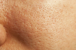 What You Can Do About Large Pores By Beauty Salon Scarborough  - Call Us On 0404 072 462